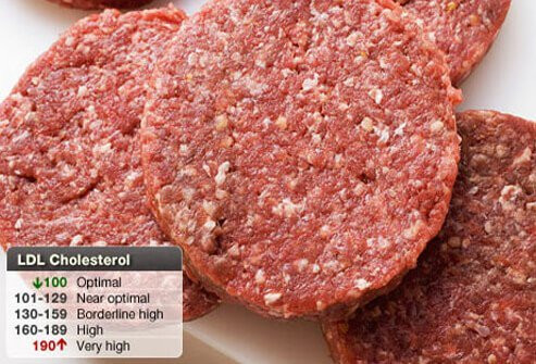 Low Density Lipoprotein (LDL)